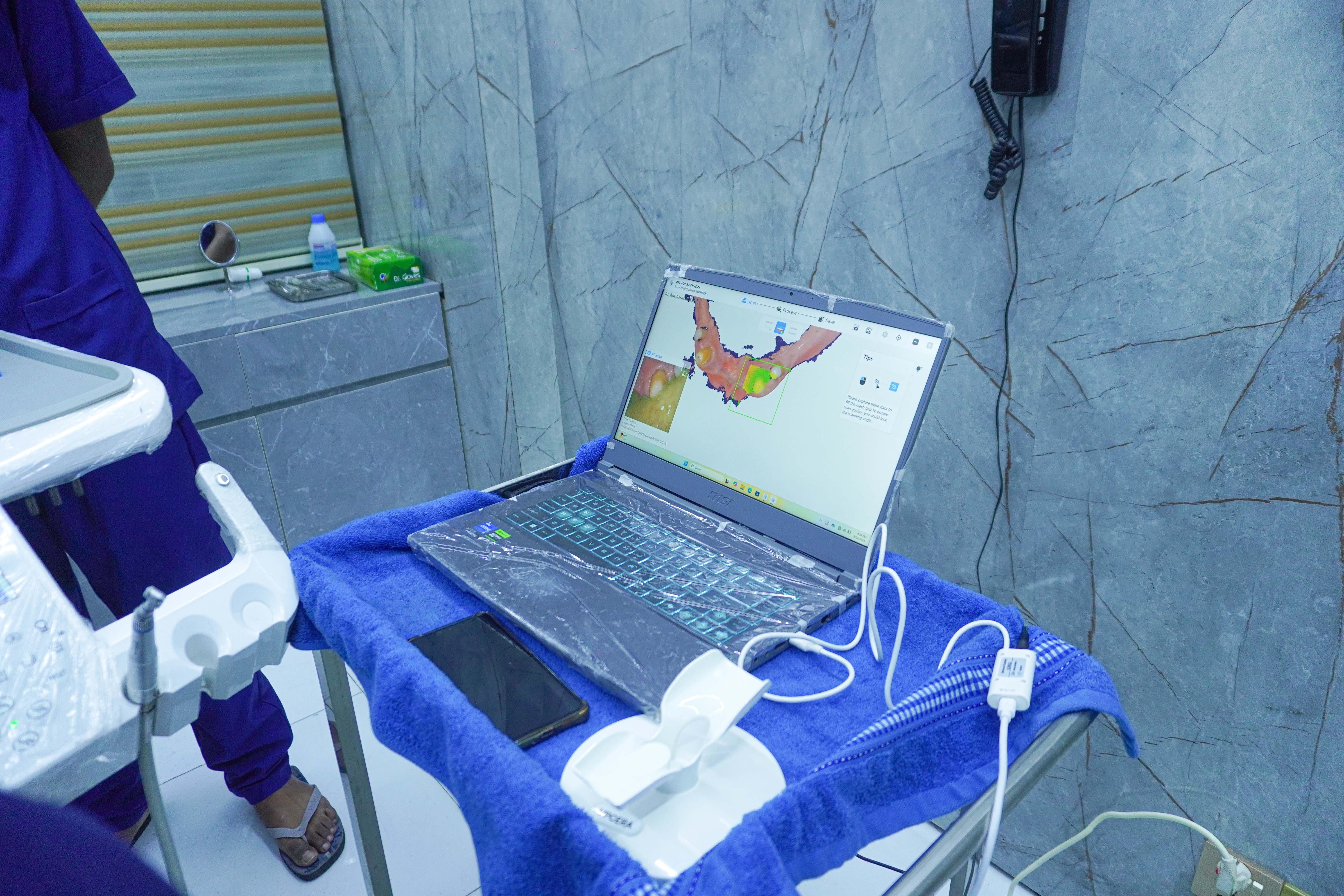 Dental Implants: A Permanent Solution for Missing Teeth